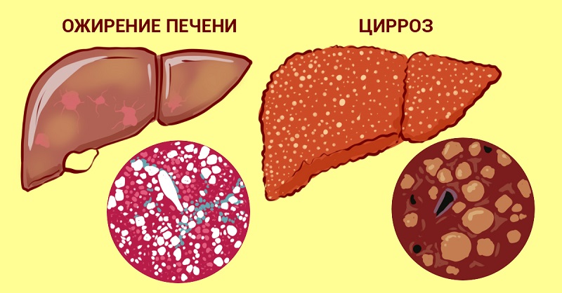 Эта хитрость защищает печень от разрушения! Нужно пить… Чтобы шлаки и токсины вышли