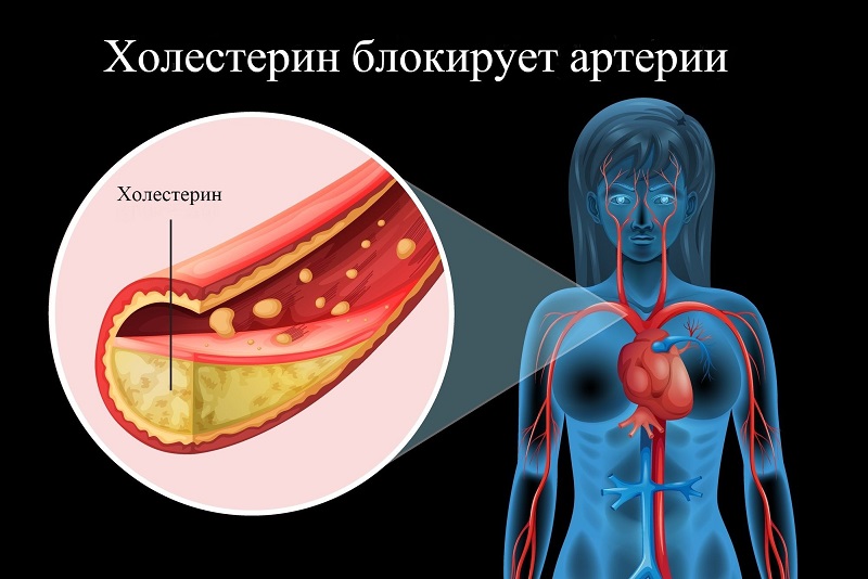 Держи сосуды в чистоте и тонусе: 5 золотых рецептов от травника. Приводим холестерин в норму и укрепляем сосуды без лекарств